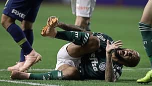 Tornozelo do felipe melo quebrado