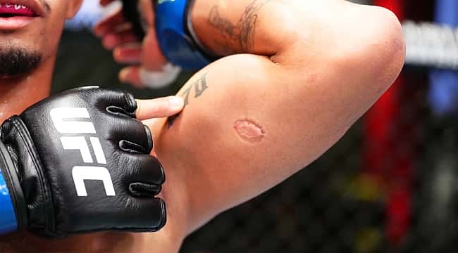 UFC Vegas 89: André "Mascote" vence após sofrer mordida de rival